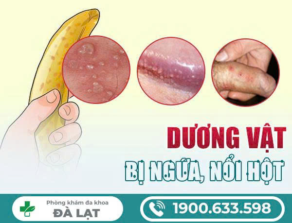 Hình ảnh minh họa