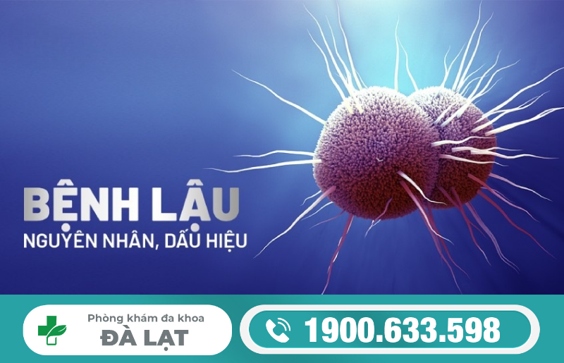 Hình ảnh minh họa