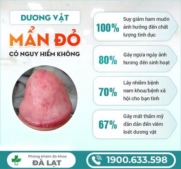 Hình ảnh minh họa