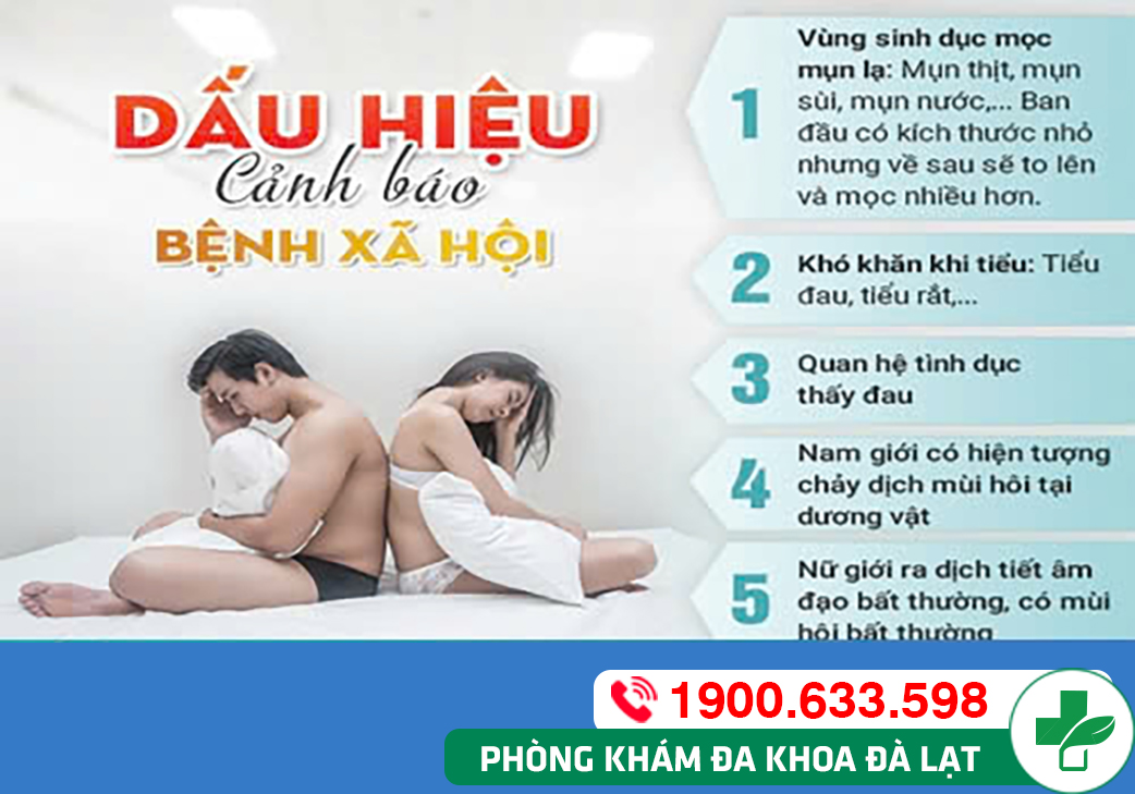Hình ảnh minh họa