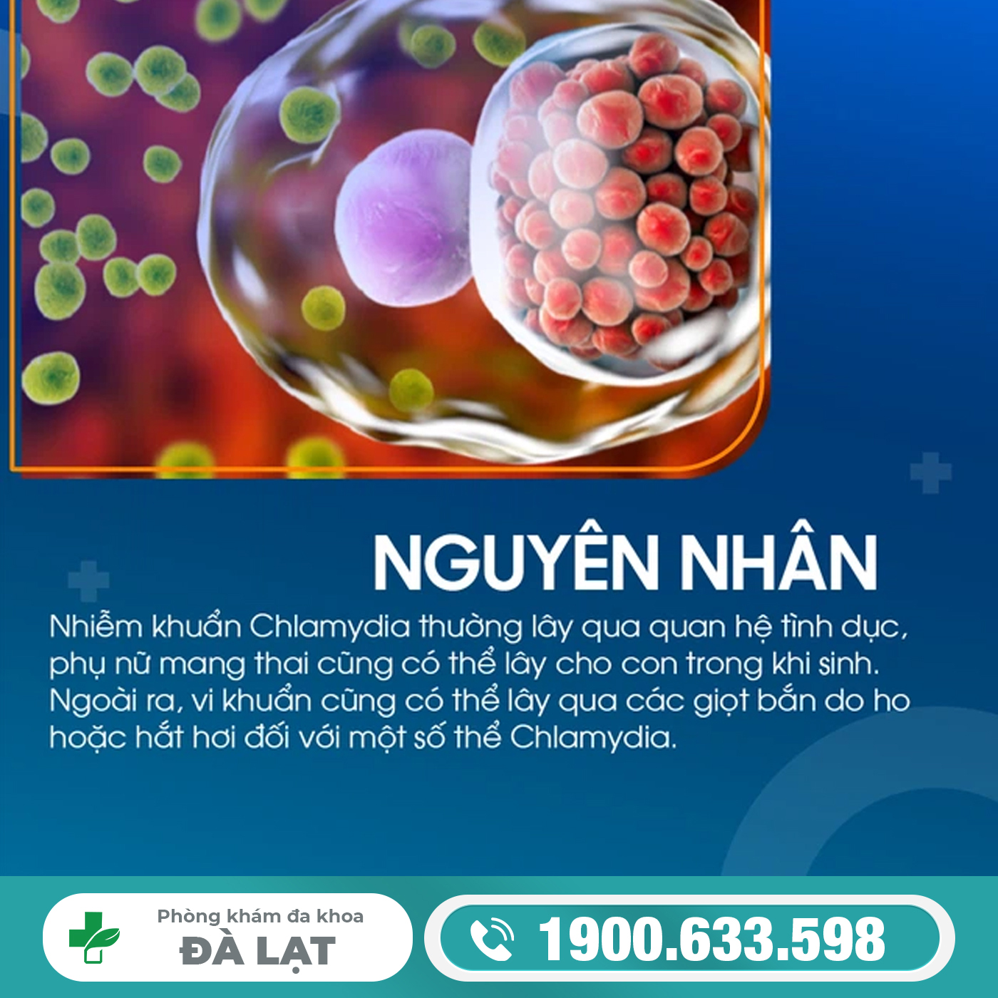Hình ảnh minh họa