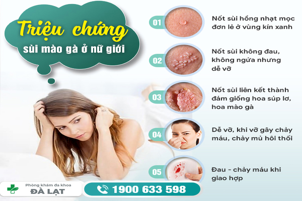 Hình ảnh minh họa