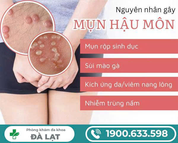 Hình ảnh minh họa