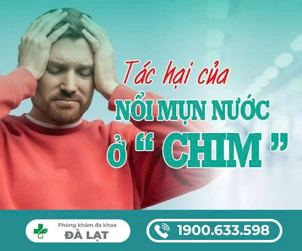 Hình ảnh minh họa