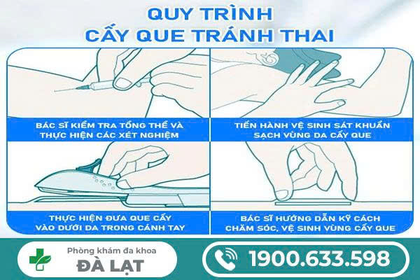 Hình ảnh minh họa