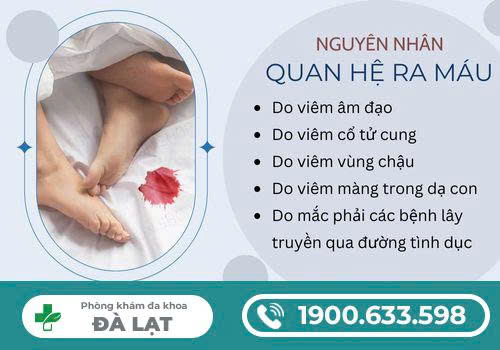 Hình ảnh minh họa