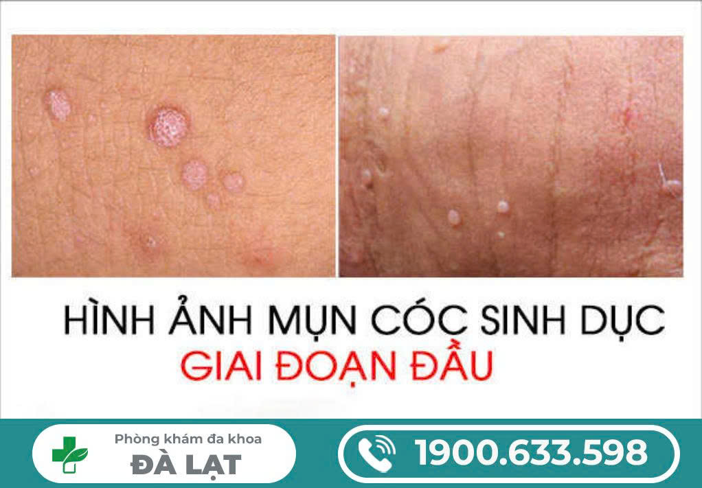 Hình ảnh minh họa