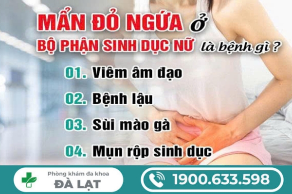 Hình ảnh minh họa