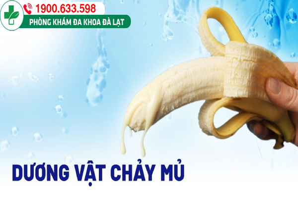 Hình ảnh minh họa