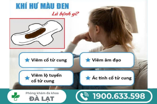 Hình ảnh minh họa