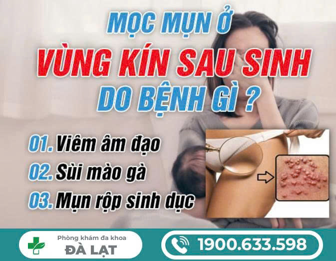 Hình ảnh minh họa