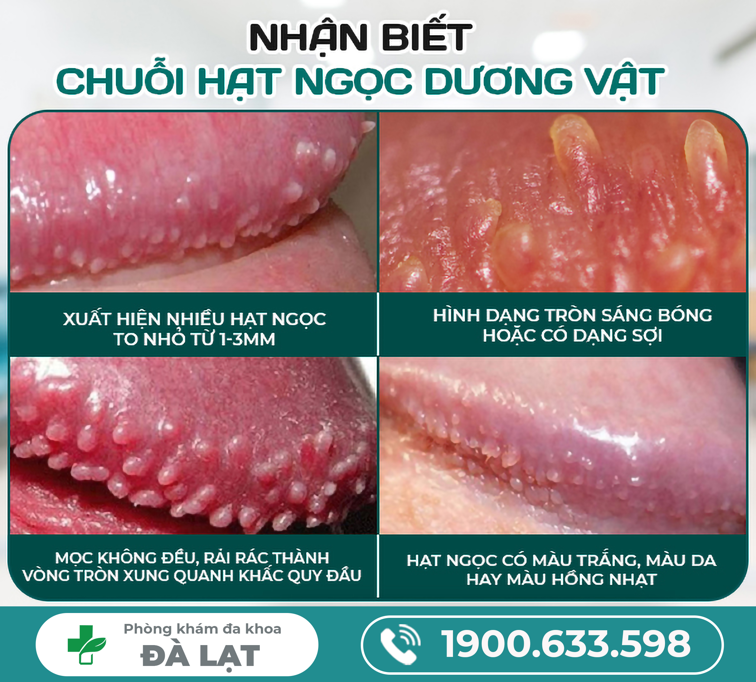 Hình ảnh minh họa