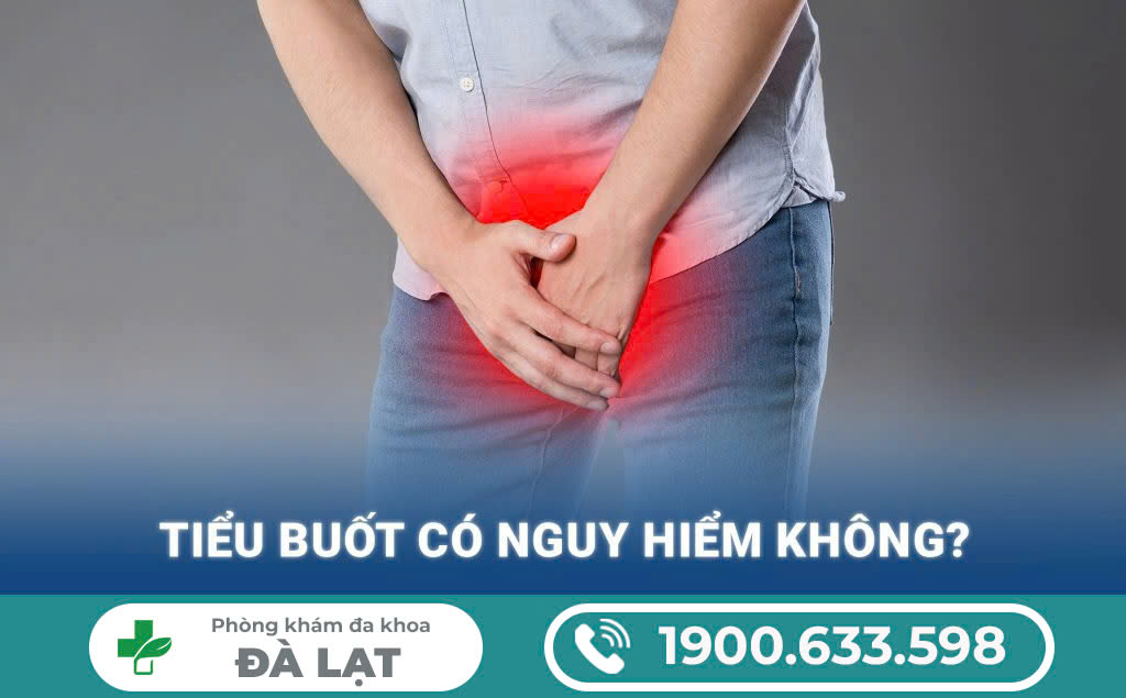 Hình ảnh minh họa