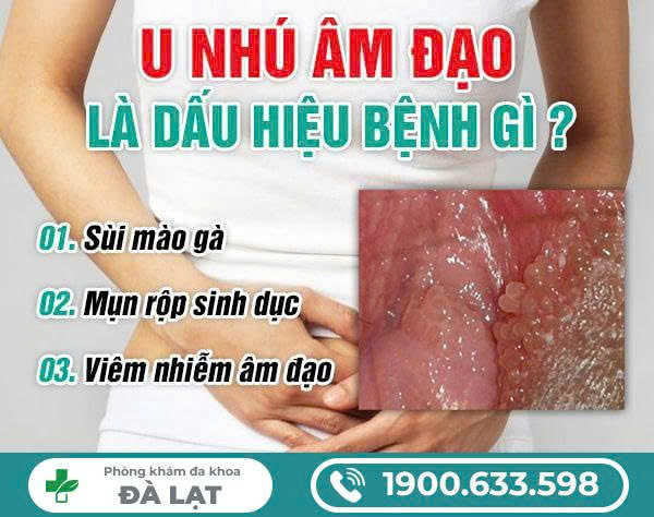 Hình ảnh minh họa