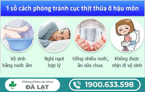 Hình ảnh minh họa