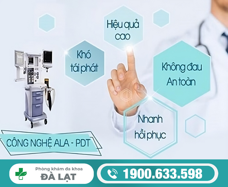 Hình ảnh minh họa