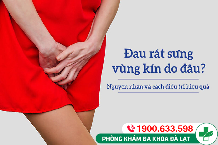 Hình ảnh minh họa
