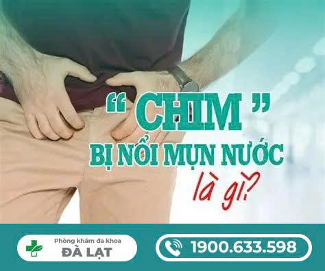 Hình ảnh minh họa